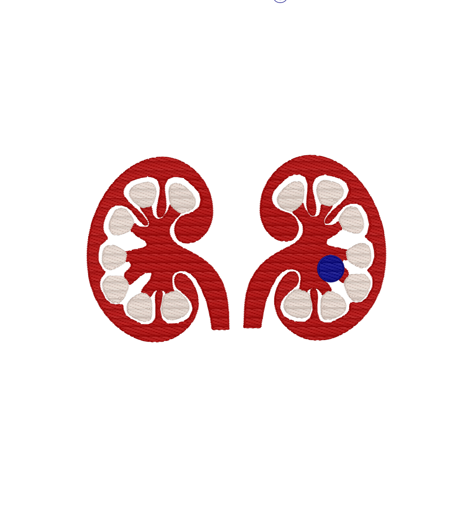 Kidney with Stone Embroidery
